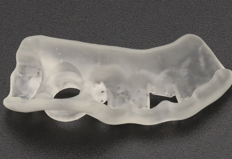 齿科3d打印机在齿科手术导板中的应用介绍