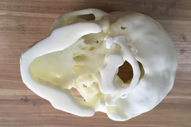 医疗领域的SLA 3D打印技术：如何选择适合的医疗3D打印机